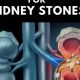 Natural Kidney Stone Remedies: Herbal Dissolve Guide | The Ultimate Herbal Remedies Guide: Natural Healing for a Healthier Life