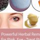 Natural Herbal Remedies for Pink Eye Relief | The Ultimate Herbal Remedies Guide: Natural Healing for a Healthier Life