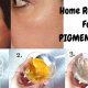 Best Herbal Treatment for Pigmentation on Face: A Guide | The Ultimate Herbal Remedies Guide: Natural Healing for a Healthier Life