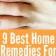 Effective Herbal Treatment for Nail Fungus Today! | The Ultimate Herbal Remedies Guide: Natural Healing for a Healthier Life