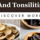Natural Tonsillitis Herbal Remedies Guide | The Ultimate Herbal Remedies Guide: Natural Healing for a Healthier Life