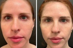 Real Herbalean Reviews: Before & After Results + Expert Analysis The Ultimate Herbal Remedies Guide: Natural Healing for a Healthier Life Real Herbalean Reviews: Before & After Results + Expert Analysis | The Ultimate Herbal Remedies Guide: Natural Healing for a Healthier Life