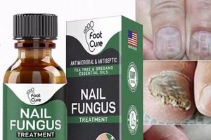 Natural Nail Fungus Herbal Treatment: Relief Guide The Ultimate Herbal Remedies Guide: Natural Healing for a Healthier Life Natural Nail Fungus Herbal Treatment: Relief Guide | The Ultimate Herbal Remedies Guide: Natural Healing for a Healthier Life