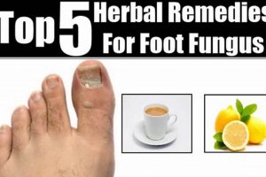 Best Herbal Treatment for Foot Fungus: Natural Remedy The Ultimate Herbal Remedies Guide: Natural Healing for a Healthier Life Best Herbal Treatment for Foot Fungus: Natural Remedy | The Ultimate Herbal Remedies Guide: Natural Healing for a Healthier Life