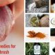 Natural Oral Thrush Herbal Treatment Relief Fast! | The Ultimate Herbal Remedies Guide: Natural Healing for a Healthier Life