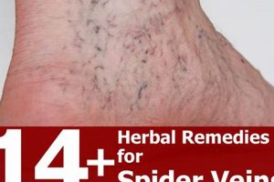 Natural Spider Veins Herbal Treatment: Relief Guide Safem Fabrication - Precision Engineering & Custom Manufacturing Solutions Natural Spider Veins Herbal Treatment: Relief Guide | Safem Fabrication - Precision Engineering & Custom Manufacturing Solutions