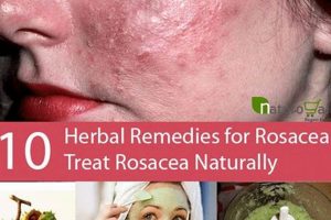Gentle Herbal Treatment for Rosacea Skin: Calm & Soothe The Ultimate Herbal Remedies Guide: Natural Healing for a Healthier Life Gentle Herbal Treatment for Rosacea Skin: Calm & Soothe | The Ultimate Herbal Remedies Guide: Natural Healing for a Healthier Life