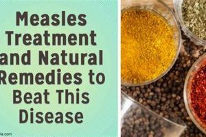 Natural Measles Herbal Treatment: Relief & Support The Ultimate Herbal Remedies Guide: Natural Healing for a Healthier Life Natural Measles Herbal Treatment: Relief & Support | The Ultimate Herbal Remedies Guide: Natural Healing for a Healthier Life