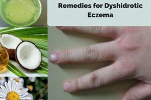 Natural Dyshidrotic Eczema Herbal Remedies: Relief Guide The Ultimate Herbal Remedies Guide: Natural Healing for a Healthier Life Natural Dyshidrotic Eczema Herbal Remedies: Relief Guide | The Ultimate Herbal Remedies Guide: Natural Healing for a Healthier Life
