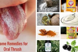 Natural Herbal Remedies for Thrush (Oral Candidiasis) Relief The Ultimate Herbal Remedies Guide: Natural Healing for a Healthier Life Natural Herbal Remedies for Thrush (Oral Candidiasis) Relief | The Ultimate Herbal Remedies Guide: Natural Healing for a Healthier Life