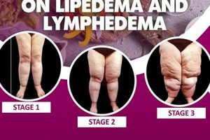 Natural Lipedema Herbal Treatment: Relief & Support The Ultimate Herbal Remedies Guide: Natural Healing for a Healthier Life Natural Lipedema Herbal Treatment: Relief & Support | The Ultimate Herbal Remedies Guide: Natural Healing for a Healthier Life
