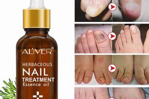 Revive Nails: Herbal Essence Nail Cream for Strong, Healthy Nails The Ultimate Herbal Remedies Guide: Natural Healing for a Healthier Life Revive Nails: Herbal Essence Nail Cream for Strong, Healthy Nails | The Ultimate Herbal Remedies Guide: Natural Healing for a Healthier Life