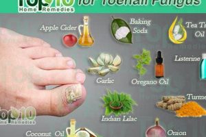 Natural Herbal Cure for Toenail Fungus: Tips & Remedies The Ultimate Herbal Remedies Guide: Natural Healing for a Healthier Life Natural Herbal Cure for Toenail Fungus: Tips & Remedies | The Ultimate Herbal Remedies Guide: Natural Healing for a Healthier Life