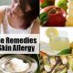 Natural Herbal Remedies for Skin Allergies Relief | The Ultimate Herbal Remedies Guide: Natural Healing for a Healthier Life