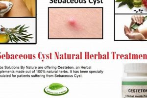 Natural Sebaceous Cyst Herbal Treatment: Relief & Remedies The Ultimate Herbal Remedies Guide: Natural Healing for a Healthier Life Natural Sebaceous Cyst Herbal Treatment: Relief & Remedies | The Ultimate Herbal Remedies Guide: Natural Healing for a Healthier Life
