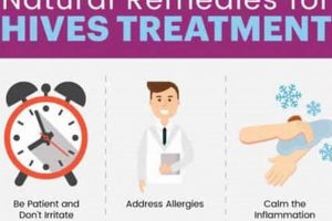Natural Herbal Treatment for Hives Relief Today The Ultimate Herbal Remedies Guide: Natural Healing for a Healthier Life Natural Herbal Treatment for Hives Relief Today | The Ultimate Herbal Remedies Guide: Natural Healing for a Healthier Life