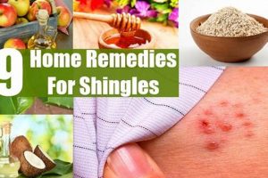 Natural Herbal Supplements for Shingles Relief The Ultimate Herbal Remedies Guide: Natural Healing for a Healthier Life Natural Herbal Supplements for Shingles Relief | The Ultimate Herbal Remedies Guide: Natural Healing for a Healthier Life