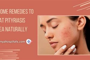 Natural Pityriasis Rosea Herbal Treatment Guide The Ultimate Herbal Remedies Guide: Natural Healing for a Healthier Life Natural Pityriasis Rosea Herbal Treatment Guide | The Ultimate Herbal Remedies Guide: Natural Healing for a Healthier Life