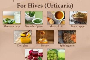 Best Herbal Remedies for Urticaria: Natural Relief The Ultimate Herbal Remedies Guide: Natural Healing for a Healthier Life Best Herbal Remedies for Urticaria: Natural Relief | The Ultimate Herbal Remedies Guide: Natural Healing for a Healthier Life