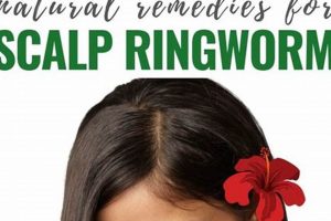 Natural Herbal Treatment for Scalp Ringworm: Relief Guide The Ultimate Herbal Remedies Guide: Natural Healing for a Healthier Life Natural Herbal Treatment for Scalp Ringworm: Relief Guide | The Ultimate Herbal Remedies Guide: Natural Healing for a Healthier Life