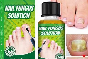 Natural Toenail Fungus Herbal Treatment Guide (Quick!) The Ultimate Herbal Remedies Guide: Natural Healing for a Healthier Life Natural Toenail Fungus Herbal Treatment Guide (Quick!) | The Ultimate Herbal Remedies Guide: Natural Healing for a Healthier Life