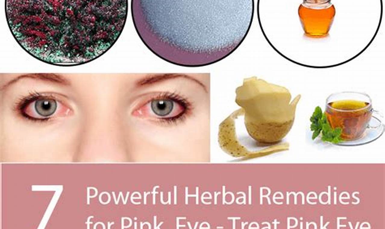 Natural Herbal Remedies for Pink Eye Relief Now The Ultimate Herbal Remedies Guide: Natural Healing for a Healthier Life Natural Herbal Remedies for Pink Eye Relief Now | The Ultimate Herbal Remedies Guide: Natural Healing for a Healthier Life