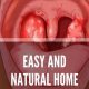 Natural Strep Throat Herbal Treatment: Relief Guide | The Ultimate Herbal Remedies Guide: Natural Healing for a Healthier Life