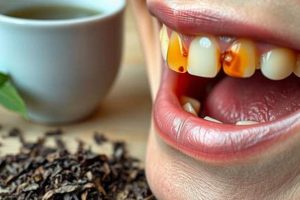 Does Herbal Tea Stain Teeth? & Tips for a Whiter Smile The Ultimate Herbal Remedies Guide: Natural Healing for a Healthier Life Does Herbal Tea Stain Teeth? & Tips for a Whiter Smile | The Ultimate Herbal Remedies Guide: Natural Healing for a Healthier Life