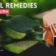 Natural Herbal Remedies for Sunburn Relief | The Ultimate Herbal Remedies Guide: Natural Healing for a Healthier Life