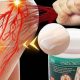 Natural Sciatica Herbal Treatment: Relief Now! | The Ultimate Herbal Remedies Guide: Natural Healing for a Healthier Life