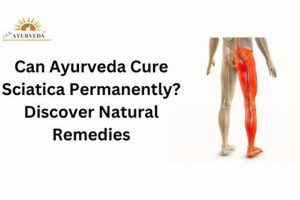 Natural Herbals: Herbal Cure for Sciatica Relief Now The Ultimate Herbal Remedies Guide: Natural Healing for a Healthier Life Natural Herbals: Herbal Cure for Sciatica Relief Now | The Ultimate Herbal Remedies Guide: Natural Healing for a Healthier Life