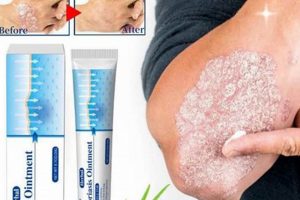 Natural Psoriasis Relief: Herbal Ointment Reviews & Tips The Ultimate Herbal Remedies Guide: Natural Healing for a Healthier Life Natural Psoriasis Relief: Herbal Ointment Reviews & Tips | The Ultimate Herbal Remedies Guide: Natural Healing for a Healthier Life