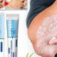Natural Psoriasis Relief: Herbal Ointment Reviews & Tips | The Ultimate Herbal Remedies Guide: Natural Healing for a Healthier Life