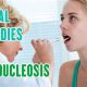 Natural Mononucleosis Herbal Remedies Guide | The Ultimate Herbal Remedies Guide: Natural Healing for a Healthier Life