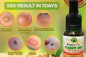 Effective Herbal Wart Remedy: Natural Solutions The Ultimate Herbal Remedies Guide: Natural Healing for a Healthier Life Effective Herbal Wart Remedy: Natural Solutions | The Ultimate Herbal Remedies Guide: Natural Healing for a Healthier Life