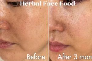 Is Herbal Face Food Legit? + Reviews & Results The Ultimate Herbal Remedies Guide: Natural Healing for a Healthier Life Is Herbal Face Food Legit? + Reviews & Results | The Ultimate Herbal Remedies Guide: Natural Healing for a Healthier Life