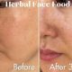 Is Herbal Face Food Legit? + Reviews & Results | The Ultimate Herbal Remedies Guide: Natural Healing for a Healthier Life