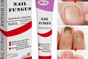 Natural Fungus Herbal Treatment: A Guide + Remedies The Ultimate Herbal Remedies Guide: Natural Healing for a Healthier Life Natural Fungus Herbal Treatment: A Guide + Remedies | The Ultimate Herbal Remedies Guide: Natural Healing for a Healthier Life