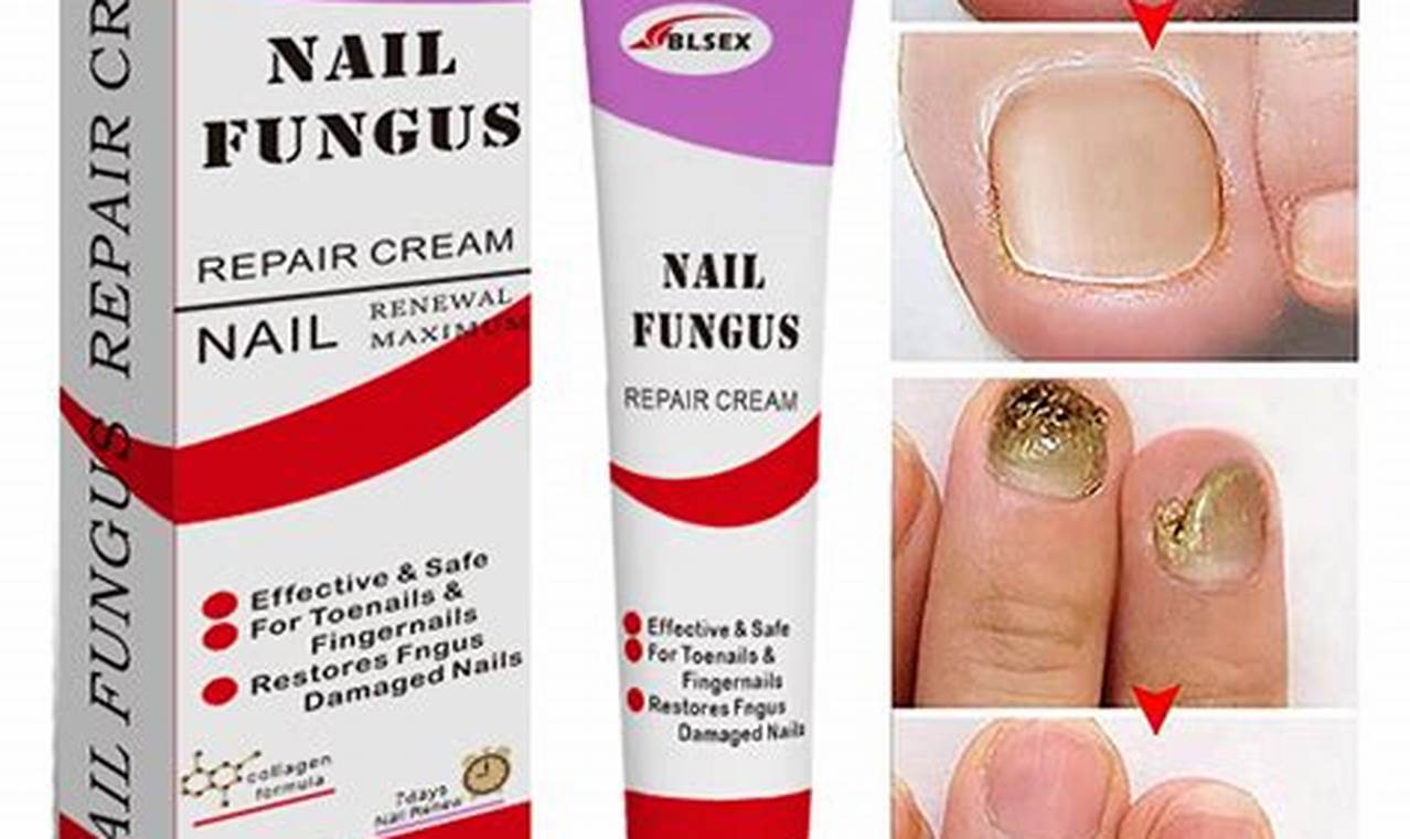 Natural Fungus Herbal Treatment: A Guide + Remedies The Ultimate Herbal Remedies Guide: Natural Healing for a Healthier Life Natural Fungus Herbal Treatment: A Guide + Remedies | The Ultimate Herbal Remedies Guide: Natural Healing for a Healthier Life