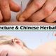 Wan Mei Woo: Acupuncture & Herbals for Wellness | The Ultimate Herbal Remedies Guide: Natural Healing for a Healthier Life