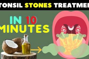 Natural Tonsil Stones Herbal Treatment: Relief Guide | The Ultimate Herbal Remedies Guide: Natural Healing for a Healthier Life