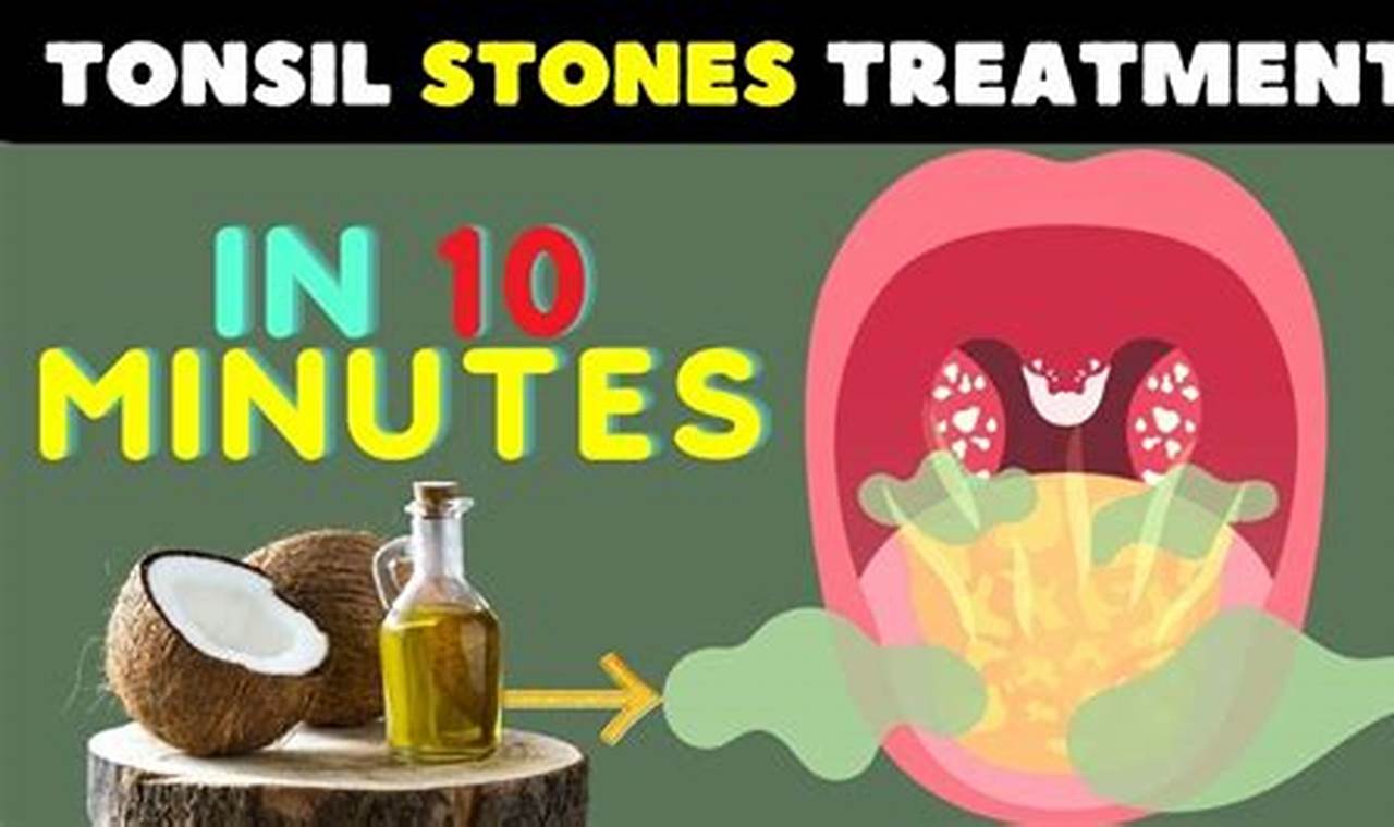 Natural Tonsil Stones Herbal Treatment: Relief Guide | The Ultimate Herbal Remedies Guide: Natural Healing for a Healthier Life
