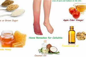Natural Herbal Cellulitis Treatment: Effective Aids | The Ultimate Herbal Remedies Guide: Natural Healing for a Healthier Life