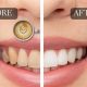 Prevent Herbal Tea Stain Teeth: Tips &amp; Tricks | The Ultimate Herbal Remedies Guide: Natural Healing for a Healthier Life