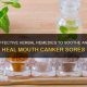 Natural Herbal Remedies for Mouth Sores: Quick Relief | The Ultimate Herbal Remedies Guide: Natural Healing for a Healthier Life