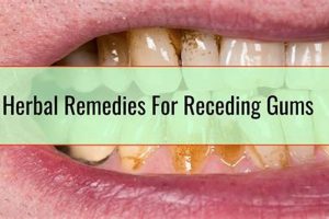 Natural Receding Gums Herbal Treatment: [Guide] | The Ultimate Herbal Remedies Guide: Natural Healing for a Healthier Life