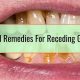 Natural Receding Gums Herbal Treatment: [Guide] | The Ultimate Herbal Remedies Guide: Natural Healing for a Healthier Life