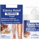 Natural Relief? Herbal Supplements & Edema: What You Need to Know | The Ultimate Herbal Remedies Guide: Natural Healing for a Healthier Life