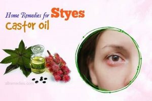 Natural Herbal Remedies for Styes: Relief Now! The Ultimate Herbal Remedies Guide: Natural Healing for a Healthier Life Natural Herbal Remedies for Styes: Relief Now! | The Ultimate Herbal Remedies Guide: Natural Healing for a Healthier Life