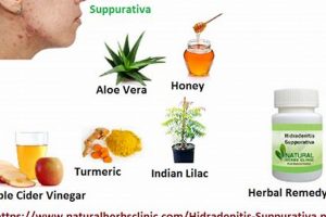 Natural Hidradenitis Suppurativa Herbal Remedies & Relief | The Ultimate Herbal Remedies Guide: Natural Healing for a Healthier Life